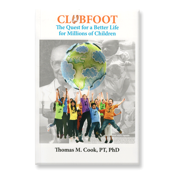 Clubfoot by Thomas M Cook, PT, PHD